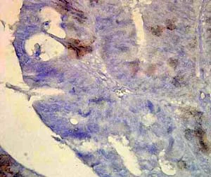 Immunohistochemistry (Formalin/PFA-fixed paraffin-embedded sections) - Anti-Hsp70 antibody [BB70] (AB53496)
