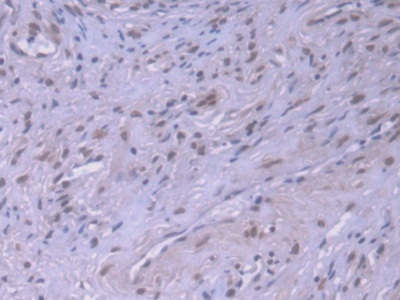 Immunohistochemistry (Formalin/PFA-fixed paraffin-embedded sections) - Anti-Hsp70 antibody [C7] (AB239732)