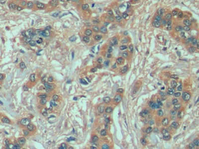 Immunohistochemistry (Formalin/PFA-fixed paraffin-embedded sections) - Anti-Hsp70 antibody [C9] (AB239496)