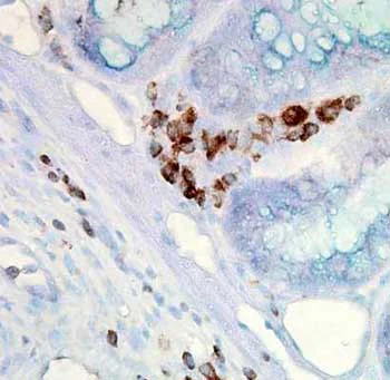 Immunohistochemistry (Formalin/PFA-fixed paraffin-embedded sections) - Anti-Hsp70 antibody [C92F3A-5] (AB47455)