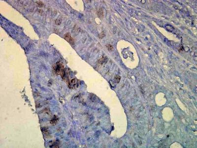Immunohistochemistry (Formalin/PFA-fixed paraffin-embedded sections) - Anti-Hsp70 antibody [C92F3A-5] (AB47455)