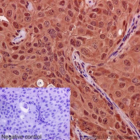 Immunohistochemistry (Formalin/PFA-fixed paraffin-embedded sections) - Anti-Hsp70 antibody [EP1007Y] (AB45133), expandable thumbnail