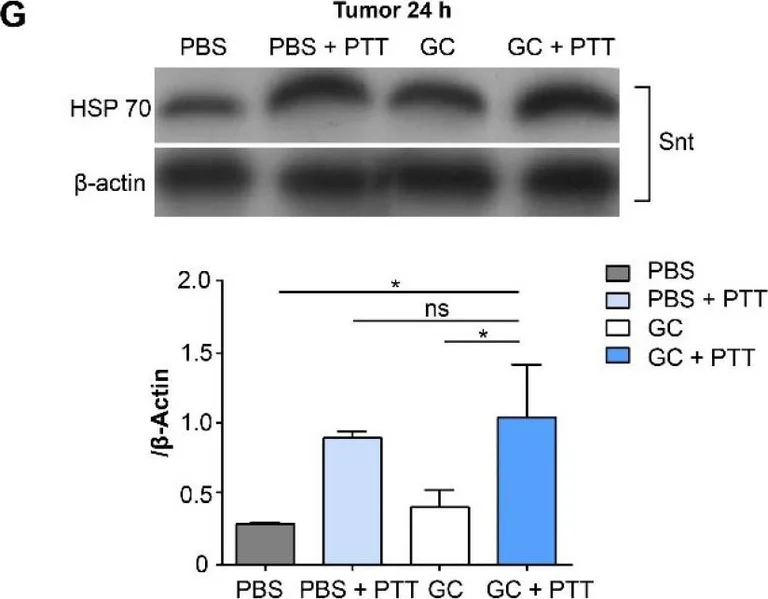Western blot - Anti-Hsp70 antibody [EPR16892] (AB181606)