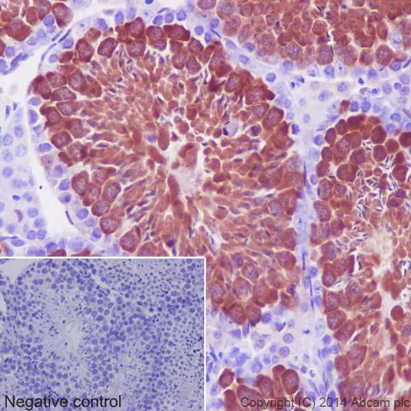 Immunohistochemistry (Formalin/PFA-fixed paraffin-embedded sections) - Anti-Hsp70 antibody [EPR16892] - BSA and Azide free (AB219597)