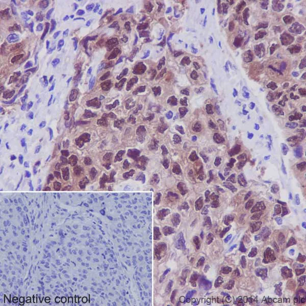 Immunohistochemistry (Formalin/PFA-fixed paraffin-embedded sections) - Anti-Hsp70 antibody [EPR16892] - BSA and Azide free (AB219597)