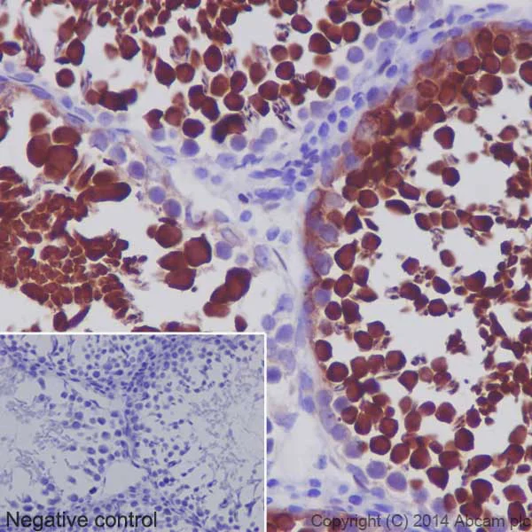 Immunohistochemistry (Formalin/PFA-fixed paraffin-embedded sections) - Anti-Hsp70 antibody [EPR16892] - BSA and Azide free (AB219597)