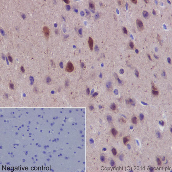 Immunohistochemistry (Formalin/PFA-fixed paraffin-embedded sections) - Anti-Hsp70 antibody [EPR16892] - BSA and Azide free (AB219597), expandable thumbnail