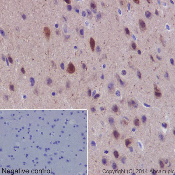 Immunohistochemistry (Formalin/PFA-fixed paraffin-embedded sections) - Anti-Hsp70 antibody [EPR16892] - BSA and Azide free (AB219597)