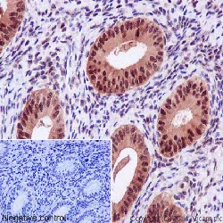 Immunohistochemistry (Formalin/PFA-fixed paraffin-embedded sections) - Anti-Hsp70 antibody [EPR16893] (AB194360)