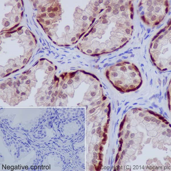 Immunohistochemistry (Formalin/PFA-fixed paraffin-embedded sections) - Anti-Hsp70 antibody [EPR17677] (AB182844)