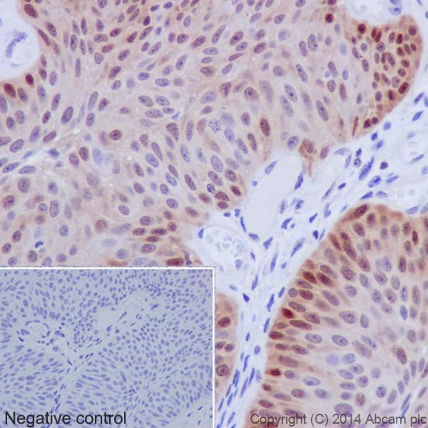 Immunohistochemistry (Formalin/PFA-fixed paraffin-embedded sections) - Anti-Hsp70 antibody [EPR17677] (AB182844)