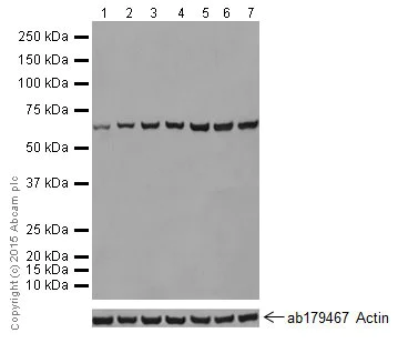 Western blot - Anti-Hsp70 antibody [EPR17677] (AB182844)