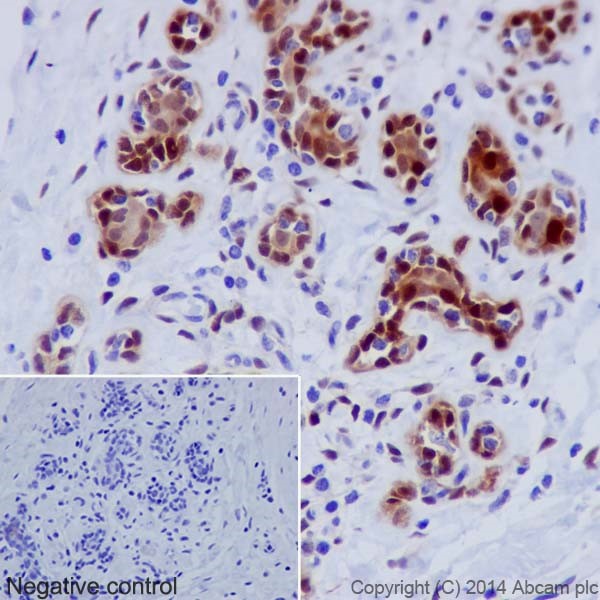 Immunohistochemistry (Formalin/PFA-fixed paraffin-embedded sections) - Anti-Hsp70 antibody [EPR17677] - BSA and Azide free (AB250639), expandable thumbnail