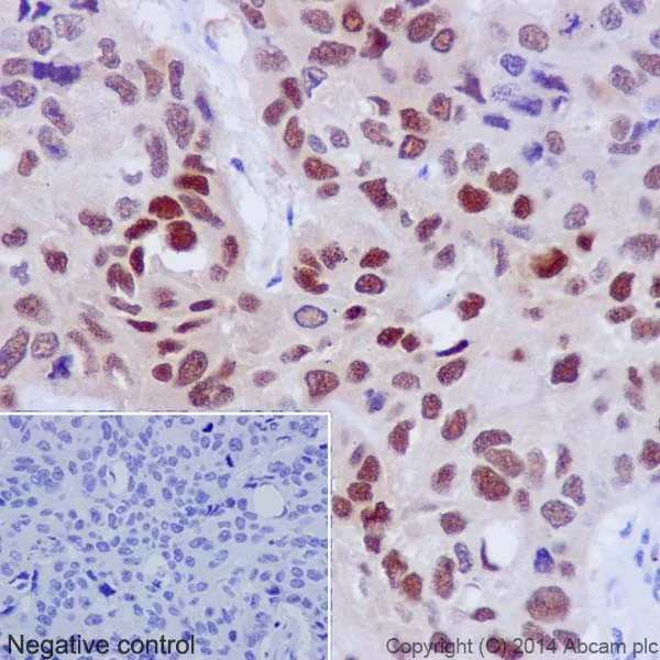 Immunohistochemistry (Formalin/PFA-fixed paraffin-embedded sections) - Anti-Hsp70 antibody [EPR17677] - BSA and Azide free (AB250639)