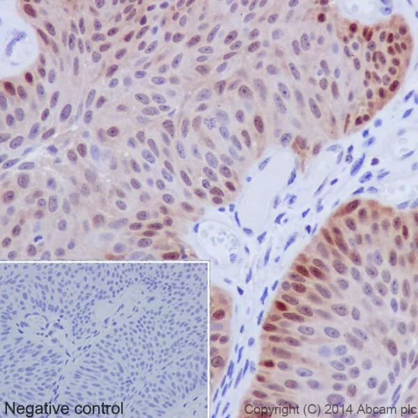 Immunohistochemistry (Formalin/PFA-fixed paraffin-embedded sections) - Anti-Hsp70 antibody [EPR17677] - BSA and Azide free (AB250639)