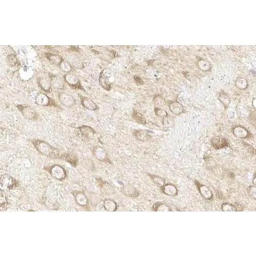 Immunohistochemistry (Formalin/PFA-fixed paraffin-embedded sections) - Anti-Hsp70 antibody [HL1580] (AB317094)