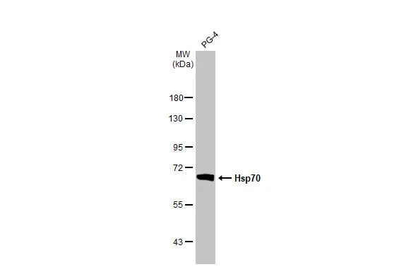 Western blot - Anti-Hsp70 antibody [HL1581] (AB308388), expandable thumbnail