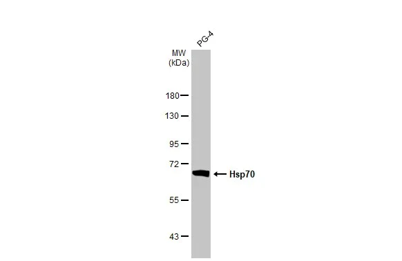 Western blot - Anti-Hsp70 antibody [HL1581] (AB308388)