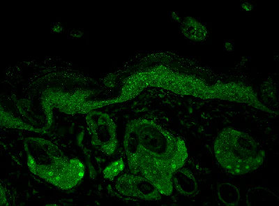 Immunohistochemistry (Formalin/PFA-fixed paraffin-embedded sections) - Anti-Hsp70 antibody [N27F3-4] (AB47454)