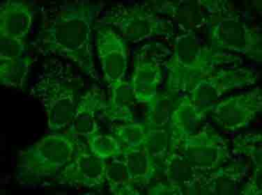 Immunocytochemistry/ Immunofluorescence - Anti-Hsp90 alpha antibody [2G5.G3] (AB79849), expandable thumbnail