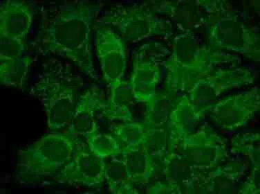 Immunocytochemistry/ Immunofluorescence - Anti-Hsp90 alpha antibody [2G5.G3] (AB79849)