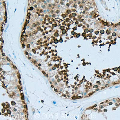 Immunohistochemistry (Formalin/PFA-fixed paraffin-embedded sections) - Anti-Hsp90 alpha antibody [2G5.G3] (AB79849), expandable thumbnail