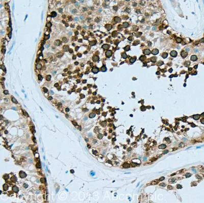 Immunohistochemistry (Formalin/PFA-fixed paraffin-embedded sections) - Anti-Hsp90 alpha antibody [2G5.G3] (AB79849)