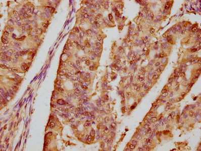Immunohistochemistry (Formalin/PFA-fixed paraffin-embedded sections) - Anti-Hsp90 alpha antibody [4B5] (AB314005)
