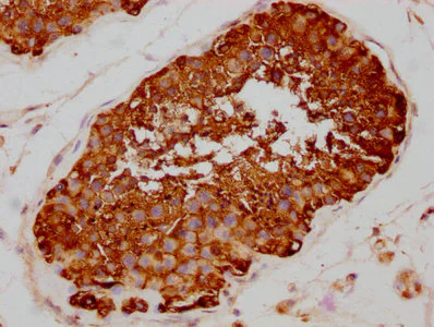 Immunohistochemistry (Formalin/PFA-fixed paraffin-embedded sections) - Anti-Hsp90 alpha antibody [4B5] (AB314005)