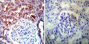 Immunohistochemistry (Formalin/PFA-fixed paraffin-embedded sections) - Anti-Hsp90 alpha antibody (AB2928)