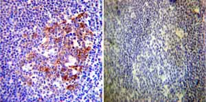 Immunohistochemistry (Formalin/PFA-fixed paraffin-embedded sections) - Anti-Hsp90 alpha antibody (AB2928)
