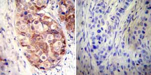 Immunohistochemistry (Formalin/PFA-fixed paraffin-embedded sections) - Anti-Hsp90 alpha antibody (AB2928)