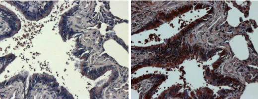 Immunohistochemistry (Formalin/PFA-fixed paraffin-embedded sections) - Anti-Hsp90 alpha antibody (AB2928)