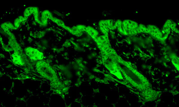 Immunocytochemistry/ Immunofluorescence - Anti-Hsp90 antibody [4F3.E8] (AB79848)