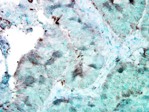 Immunohistochemistry (Formalin/PFA-fixed paraffin-embedded sections) - Anti-Hsp90 antibody [4F3.E8] (AB79848)