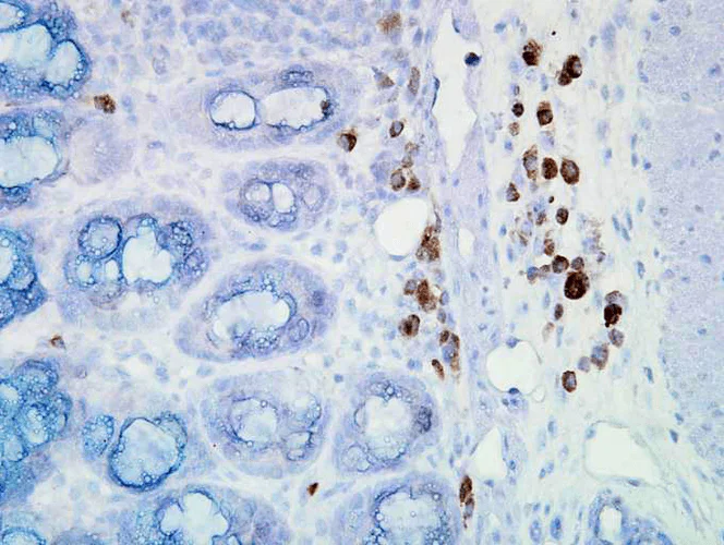 Immunohistochemistry (Formalin/PFA-fixed paraffin-embedded sections) - Anti-Hsp90 antibody [D7a] (AB59459)
