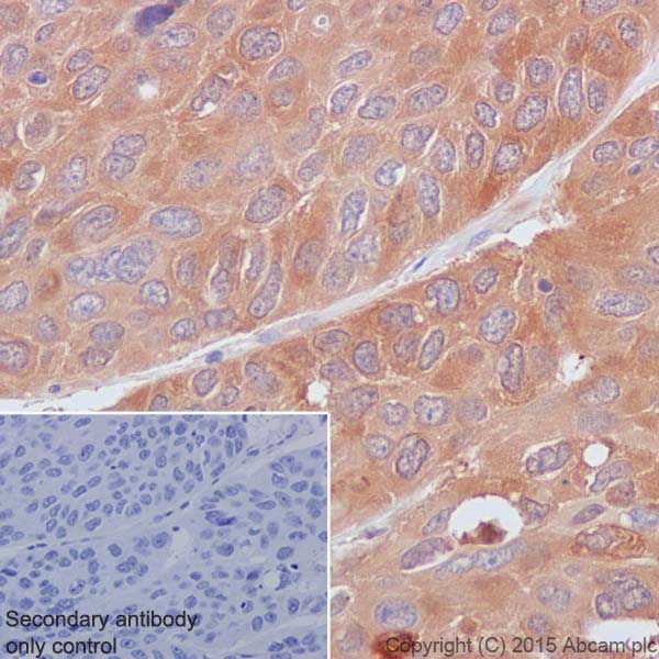 Immunohistochemistry (Formalin/PFA-fixed paraffin-embedded sections) - Anti-Hsp90 antibody [EPR16621-67] (AB203126)