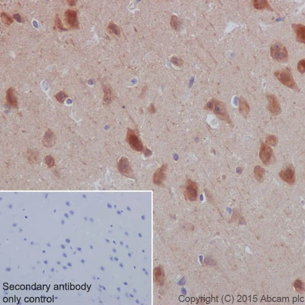Immunohistochemistry (Formalin/PFA-fixed paraffin-embedded sections) - Anti-Hsp90 antibody [EPR16621-67] (AB203126)
