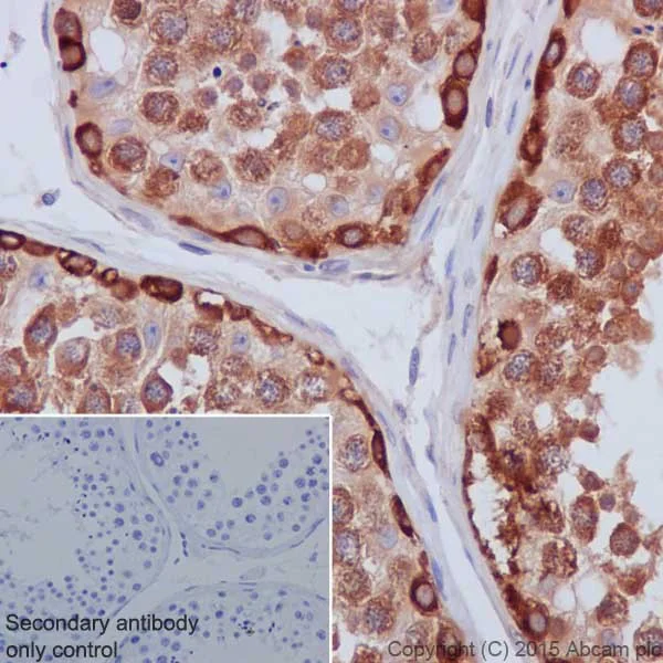 Immunohistochemistry (Formalin/PFA-fixed paraffin-embedded sections) - Anti-Hsp90 antibody [EPR16621-67] - BSA and Azide free (AB240366)