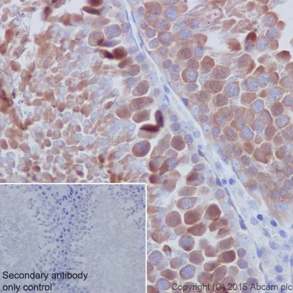 Immunohistochemistry (Formalin/PFA-fixed paraffin-embedded sections) - Anti-Hsp90 antibody [EPR16621-67] - BSA and Azide free (AB240366)