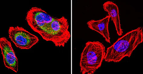 Immunocytochemistry/ Immunofluorescence - Anti-Hsp90 beta antibody (AB2927)