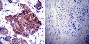 Immunohistochemistry (Formalin/PFA-fixed paraffin-embedded sections) - Anti-Hsp90 beta antibody (AB2927)