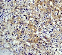 Immunohistochemistry (Formalin/PFA-fixed paraffin-embedded sections) - Anti-Hsp90 beta antibody [E296] (ab32568), expandable thumbnail