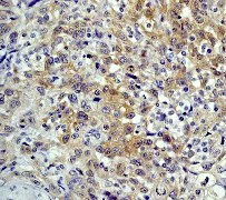 Immunohistochemistry (Formalin/PFA-fixed paraffin-embedded sections) - Anti-Hsp90 beta antibody [E296] (AB32568)
