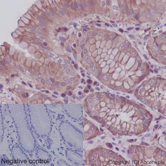 Immunohistochemistry (Formalin/PFA-fixed paraffin-embedded sections) - Anti-Hsp90 beta antibody [E296] (AB32568), expandable thumbnail