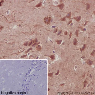 Immunohistochemistry (Formalin/PFA-fixed paraffin-embedded sections) - Anti-Hsp90 beta antibody [EPR16621] (AB203085)