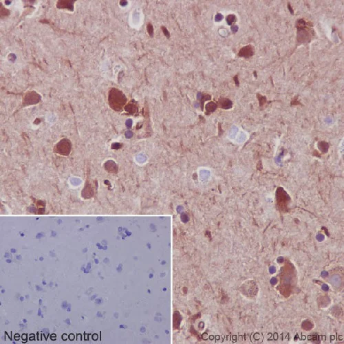 Immunohistochemistry (Formalin/PFA-fixed paraffin-embedded sections) - Anti-Hsp90 beta antibody [EPR16621] (AB203085)