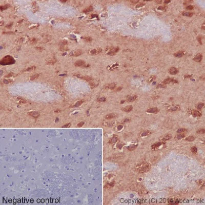 Immunohistochemistry (Formalin/PFA-fixed paraffin-embedded sections) - Anti-Hsp90 beta antibody [EPR16621] - BSA and Azide free (AB251390)