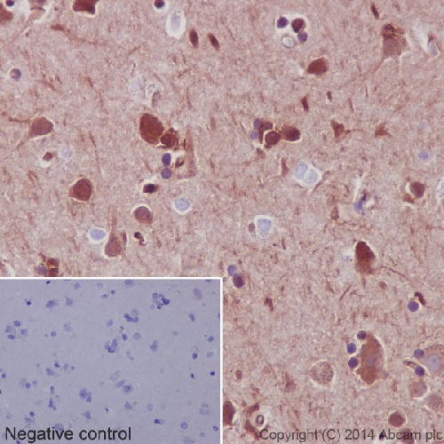 Immunohistochemistry (Formalin/PFA-fixed paraffin-embedded sections) - Anti-Hsp90 beta antibody [EPR16621] - BSA and Azide free (ab251390), expandable thumbnail