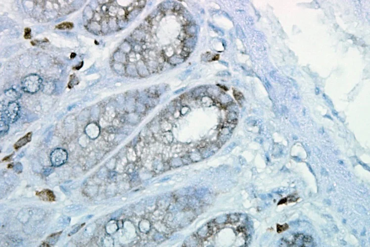 Immunohistochemistry (Formalin/PFA-fixed paraffin-embedded sections) - Anti-Hsp90 beta antibody [H90-10] (AB53497)